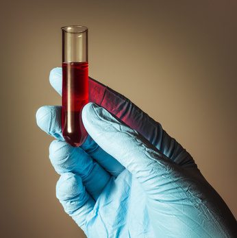 Could A New Storage System Have Prevented the Recent Smallpox Near-Miss?